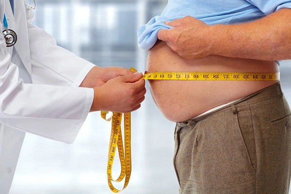 ожирение, лишний вес, ВСП, Всероссийский союз пациентов, бариатрическая хирургия