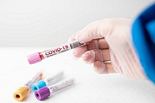 коронавирус, COVID-19, эпидемия, пандемия, ПЦР-тест, Сергей Леонов, медуслуги, исследования