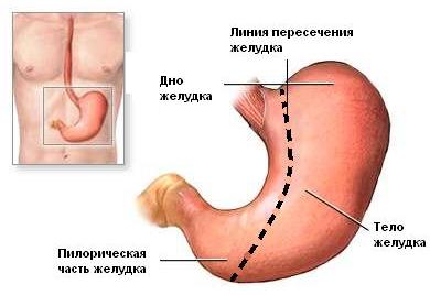 бариатрическая хирургия