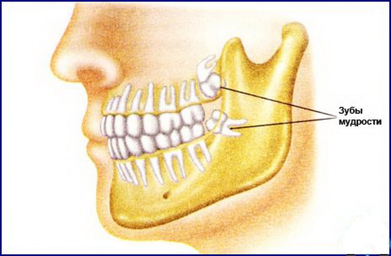 Зубы мудрости где расположены и какие по счету у человека фото