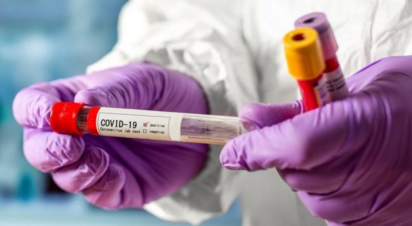 коронавирус, COVID-19, пандемия, эпидемия
