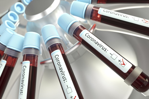 коронавирус, COVID-19, эпидемия, пандемия, режим ЧС, карантин
