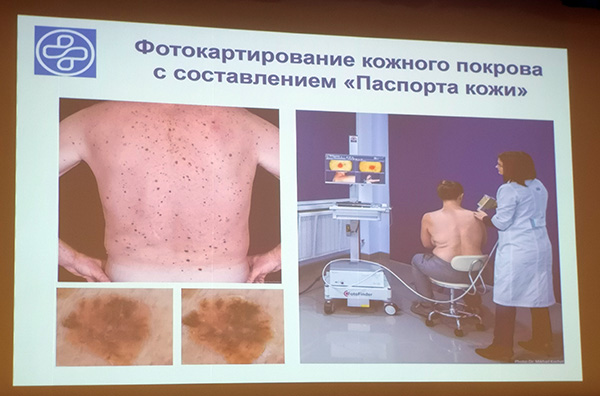 Анатолий Герец, Краевой клинический кожно-венерологический диспансер, дерматоскопия