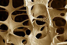 20 октября – Всемирный день профилактики остеопороза