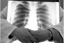 Московские врачи чаще всего переучиваются на рентгенологов
