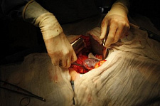 Трансплантация органов: сегодня и завтра