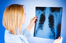 ВОЗ: заболеваемость туберкулезом за 25 лет сократилась вдвое