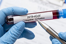коронавирус, COVID-19, эпидемия, пандемия