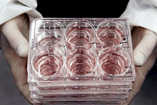 В Италии разрешили терапию стволовыми клетками без клинических испытаний 