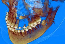 Стоматологов Владивостока научили пользоваться томографом