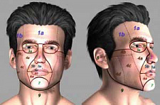 Пациенту восстановили лицо с помощью уникальной технологии
