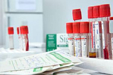 Доктор Чил-Кан Ен создал первую безопасную вакцину против ВИЧ