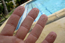 Ученые узнали, почему кожа на пальцах морщится в воде