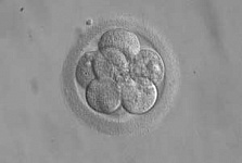 Вопрос отбора эмбрионов по половому признаку при ЭКО до сих пор не урегулирован
