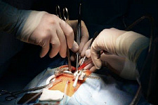 Хирурги в Киргизии прооперировали сердце при свете мобильных телефонов