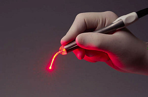 Новые технологии лазерной стоматологии