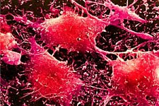 Впервые подтверждено существование раковых стволовых клеток