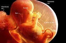 В Небраске запретили поздние аборты во избежание страданий эмбрионов