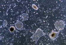 Ученые в США получили 13 новых линий стволовых клеток