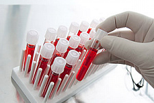 Цена на анализ крови на ХГЧ