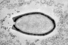 Французские ученые обнаружили гигантский новый вирус