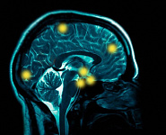 Найден участок мозга, отвечающий за борьбу с соблазнами