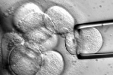 Минздрав РФ запретит использование эмбриональных стволовых клеток