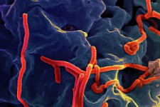 В Японии изобрели препарат, способный выявить вирус Эбола за 15 минут