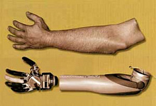 Для ветеранов США создали роботизированный протез