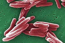 В доклинических испытаниях доказана эффективность нового метода лечения туберкулеза