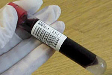 Дешевый тест, выявляющий рак на начальной стадии, появится в России в 2012 году