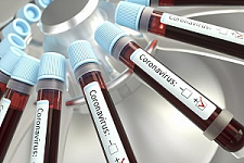 тест-система, омикрон, коронавирус, COVID-19, эпидемия, пандемия