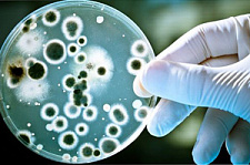 В США обнаружили смертоносную супербактерию