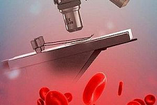 Новая технология поможет провести анализ крови без укола