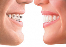 Ортодонтия - вчера и сегодня