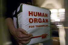 Голикова: законы о трансплантации органов будут изменены