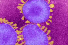 Роспотребнадзор рекомендовал проверять на коронавирус всех пациентов с кашлем и температурой