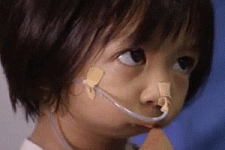 Хирурги помогли девочке с «зашитым» ртом