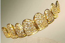 Стоматологи в Дубае создали «самую дорогую улыбку в мире»  