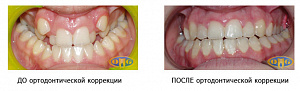 Ортодонтикс групп стоматологическая клиника