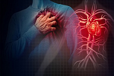 ССЗ, сердечно-сосудистые заболевания, сердце, кардиология