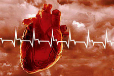 Смертность от сердечно-сосудистых заболеваний в Европе снижается