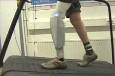 Первый в миру бионический коленный протез представили в Лондоне