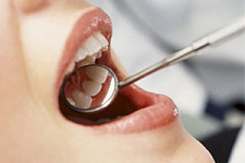 Минздрав хочет отказаться от лицензирования профилактической стоматологии