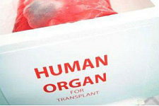 Минздрав увеличивает количество учреждений, проводящих трансплантацию органов 